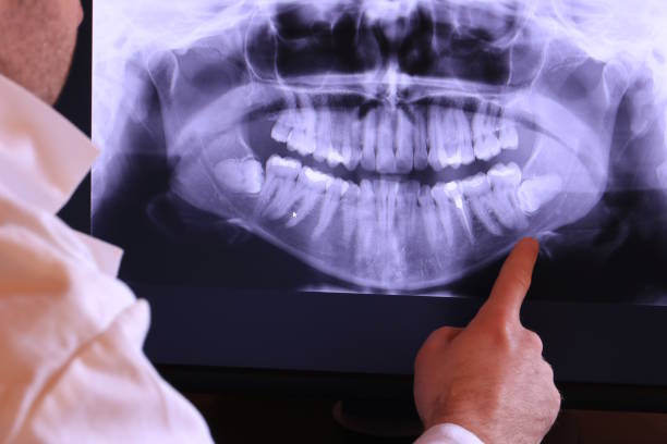 Best Teeth Whitening  in Ethete, WY