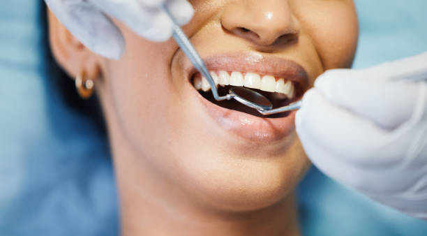 Best Teeth Whitening  in Ethete, WY