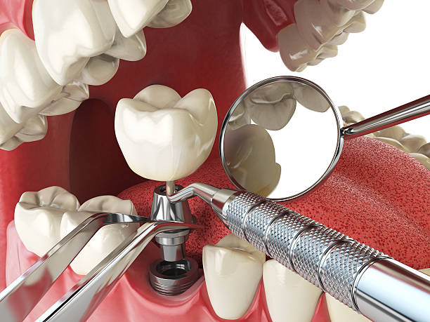 Best Tooth Infection Emergency Dentist  in Ethete, WY