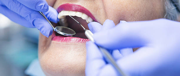 Best Chipped Tooth Repair Near Me  in Ethete, WY