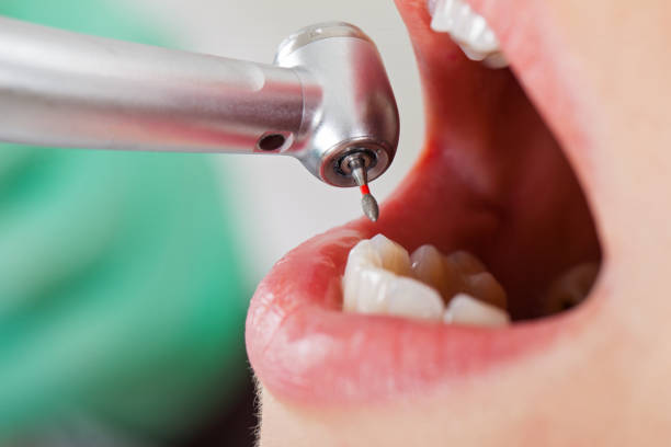 Reliable WY Emergency Dentist Solutions